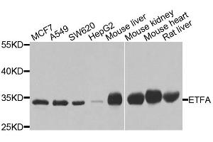 Western blot analysis of extracts of various cell lines, using ETFA antibody (ABIN5975750) at 1/1000 dilution. (ETFA Antikörper)
