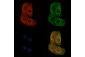ABIN6257150 and ABIN6274352 staining Hela cells by IF/ICC. (E2F2 Antikörper  (Internal Region))