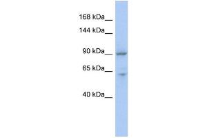 WB Suggested Anti-MLXIP Antibody Titration:  0. (MLXIP Antikörper  (Middle Region))