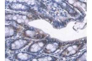 Detection of CBR1 in Mouse Colon Tissue using Polyclonal Antibody to Carbonyl Reductase 1 (CBR1) (CBR1 Antikörper  (AA 66-271))