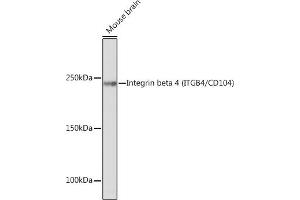 Western blot analysis of extracts of Mouse brain, using Integrin beta 4 (ITGB4/CD104) (ITGB4/CD104) Rabbit mAb (ABIN7267931) at 1:500 dilution. (Integrin beta 4 Antikörper)