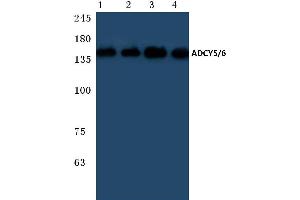 Western blot (WB) analysis of ADCY 5/6 antibody at 1/500 dilution (ADCY5 Antikörper)