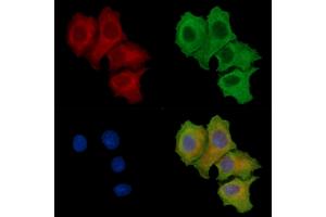 ABIN7096853 and ABIN7100919 staining HepG2 cells by IF/ICC. (TOM1L1 Antikörper)