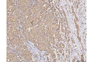 IHC analysis of Calmegin/CLGN using anti-Calmegin/CLGN antibody (ABIN7601481). (Calmegin Antikörper  (AA 36-610))