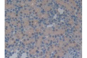 DAB staining on IHC-P; Samples: Rat Kidney Tissue (Neurotensin Antikörper  (AA 21-156))
