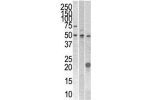 STYK1 antibody western blot analysis with 293, CEM, and mouse kidney cell line/tissue lysate (STYK1 Antikörper  (AA 31-64))
