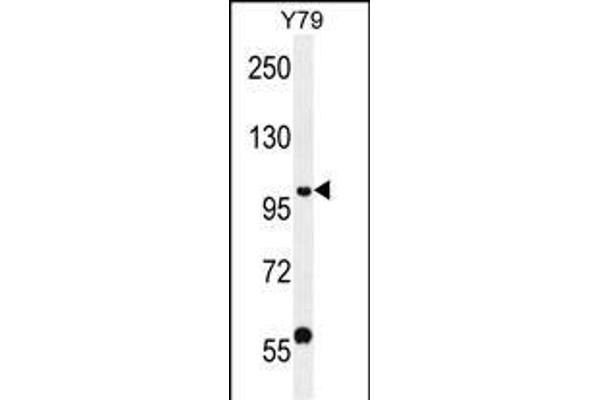 PHF20 Antikörper  (N-Term)