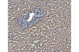 IHC analysis of PDIA6 using anti-PDIA6 antibody (ABIN7600553). (PDIA6 Antikörper  (AA 20-440))