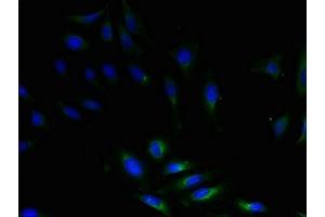 Immunofluorescent analysis of Hela cells using ABIN7149863 at dilution of 1:100 and Alexa Fluor 488-congugated AffiniPure Goat Anti-Rabbit IgG(H+L) (SAT1 Antikörper  (AA 5-171))