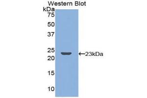 Western blot analysis of the recombinant protein. (TNFRSF11A Antikörper  (AA 359-542))