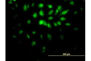 Immunofluorescence of monoclonal antibody to E2F6 on HeLa cell. (E2F6 Antikörper  (AA 1-281))