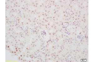 Formalin-fixed and paraffin embedded mouse kidney labeled with Anti-PINX-1 Polyclonal Antibody, Unconjugated (ABIN1387106) at 1:200 followed by conjugation to the secondary antibody and DAB staining