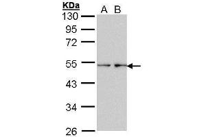 WB Image Sample (30 ug of whole cell lysate) A: HeLa B: Hep G2 , 7. (Fascin Antikörper  (Internal Region))