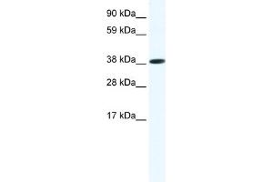 WB Suggested Anti-OBOX6 Antibody Titration:  1. (OBOX6 Antikörper  (Middle Region))