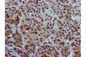 Image no. 14 for anti-Glutathione S-Transferase theta 2 (GSTT2) antibody (ABIN1498553) (GSTT2 Antikörper)