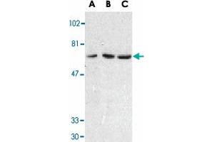Western blot analysis of TNFRSF10C in HeLa cell (A), mouse (B) and rat (C) liver tissue lysates with TNFRSF10C polyclonal antibody  at 1 ug/mL . (DcR1 Antikörper  (Extracellular Domain))