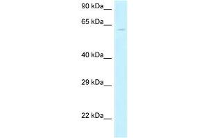 WB Suggested Anti-MON1B Antibody Titration: 1. (MON1B Antikörper  (N-Term))