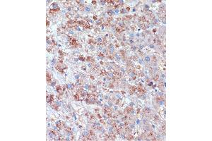 Immunohistochemistry (IHC) image for anti-T-Cell, Immune Regulator 1, ATPase, H+ Transporting, Lysosomal V0 Subunit A3 (TCIRG1) (AA 1-130) antibody (ABIN7270707)