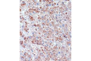 Immunohistochemistry of paraffin-embedded Human liver using TCIRG1 Rabbit pAb (ABIN7270707) at dilution of 1:100 (40x lens). (TCIRG1 Antikörper  (AA 1-130))