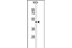 Western blot analysis of Phospho-GATA6-p (ABIN651256 and ABIN2840157) in WiDr cell line lysates (35 μg/lane). (GATA6 Antikörper  (AA 254-279))