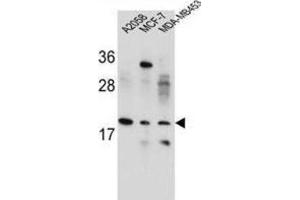 Western Blotting (WB) image for anti-Variable Charge, X-Linked (VCX) antibody (ABIN2995866) (VCX Antikörper)