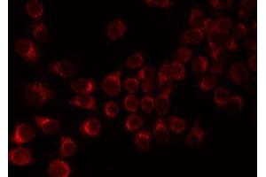 ABIN6276821 staining 293 by IF/ICC. (F12 Antikörper  (C-Term))