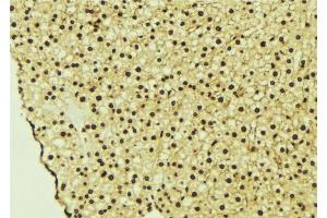 ABIN6277229 at 1/100 staining Mouse liver tissue by IHC-P. (CASK Antikörper  (Internal Region))