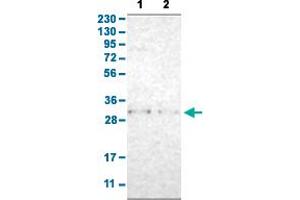 Western Blot analysis with TNFAIP1 polyclonal antibody . (TNFAIP1 Antikörper  (AA 80-170))
