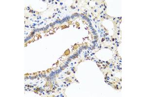 Immunohistochemistry of paraffin-embedded rat lung using CHI3L2 antibody (ABIN5975154) at dilution of 1/100 (40x lens). (CHI3L2 Antikörper)