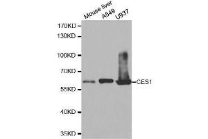 Western blot analysis of extracts of various cell lines, using CES1 antibody.