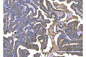 IHC analysis of RALBP1 using anti-RALBP1 antibody (ABIN7600800). (RALBP1 Antikörper  (AA 239-506))