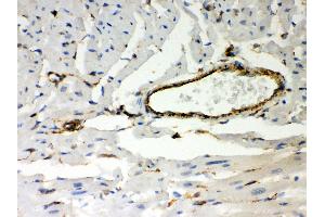 Anti- Vimentin Picoband antibody, IHC(P) IHC(P): Mouse Cardiac Muscle Tissue (Vimentin Antikörper  (C-Term))