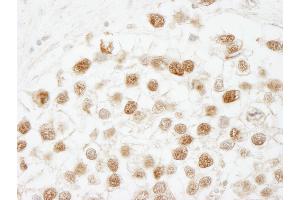 anti-Chromatin Assembly Factor 1, Subunit B (p60) (CHAF1B) (C-Term) antibody