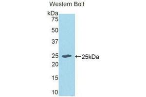 Western Blotting (WB) image for anti-Epithelial Cell Transforming Sequence 2 Oncogene (ECT2) (AA 166-348) antibody (ABIN1175693)