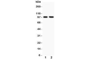 Western blot testing of LFA-1 antibody and Lane 1:  Jurkat;  2: CEM;  Predicted/Observed size: 85~95KD depending on glycosylation level (ITGAL Antikörper  (AA 404-769))