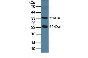 Detection of NOS1AP in Mouse Serum using Polyclonal Antibody to Nitric Oxide Synthase 1 Adaptor Protein (NOS1AP) (NOS1AP Antikörper  (AA 19-251))