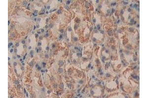 Immunohistochemistry (IHC) image for anti-Dihydrolipoamide Dehydrogenase (DLD) (AA 45-271) antibody (ABIN7432892)