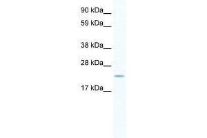 WB Suggested Anti-SERTAD1 Antibody   Titration: 0. (SERTAD1 Antikörper  (N-Term))