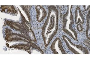 IHC analysis of U2AF65/U2AF2 using anti U2AF65/U2AF2 antibody (ABIN7600794). (U2AF2 Antikörper  (AA 238-470))