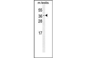 ODF3 Antikörper  (C-Term)