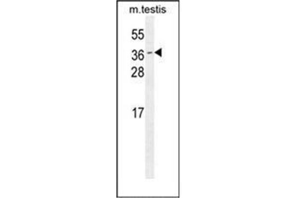 ODF3 Antikörper  (C-Term)