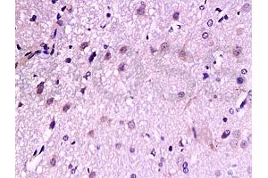 Formalin-fixed and paraffin embedded: rat brain tissue labeled with Anti-TrkB Polyclonal Antibody, Unconjugated (ABIN727310) at 1:200, followed by conjugation to the secondary antibody and DAB staining (TRKB Antikörper  (AA 32-120))