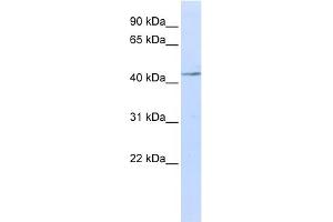 WB Suggested Anti-IL11RA Antibody Titration:  0. (IL11RA Antikörper  (N-Term))