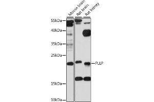 Western blot analysis of extracts of various cell lines, using PLLP antibody (ABIN7269390) at 1:1000 dilution. (Plasmolipin Antikörper  (AA 1-100))