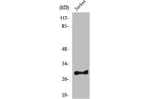 Western Blot analysis of HeLa cells using Rim4 Polyclonal Antibody (RIMS4 Antikörper  (Internal Region))