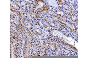IHC analysis of YY1 using anti-YY1 antibody (ABIN7602999).