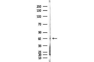 anti-Transcription Factor B1, Mitochondrial (TFB1M) antibody