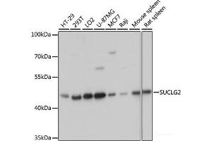 Western blot analysis of extracts of various cell lines using SUCLG2 Polyclonal Antibody at dilution of 1:3000. (SUCLG2 Antikörper)