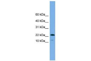 WFDC1 antibody used at 1 ug/ml to detect target protein. (WFDC1 Antikörper  (N-Term))