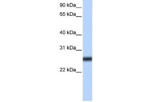 TMPRSS5 antibody used at 2 ug/ml to detect target protein. (TMPRSS5 Antikörper)